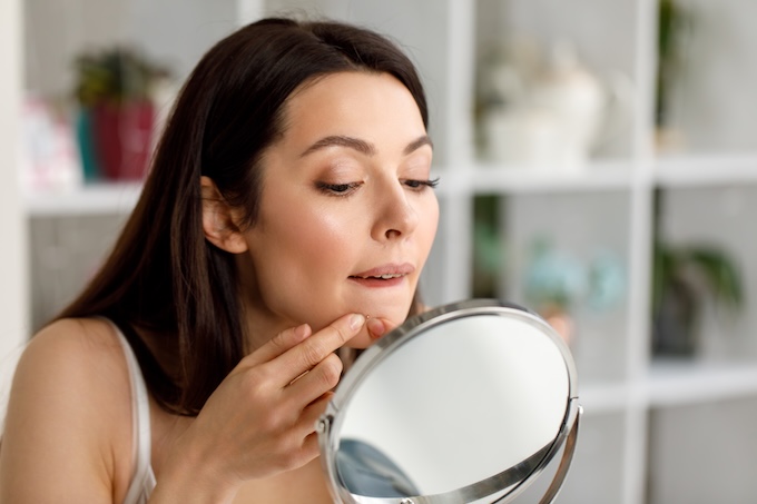 почему акне на лице